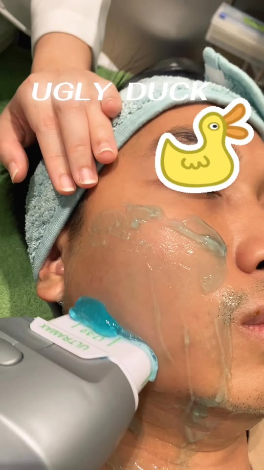 การทำ HIFU ที่ Ugly Duck Clinic